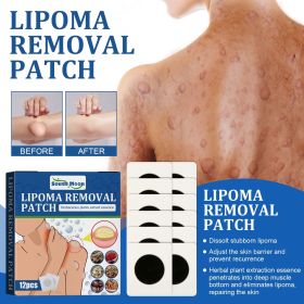 South Moon Lipoma Removal Patch, Various Fat Knots To Subcutaneous Lumps Care Patch